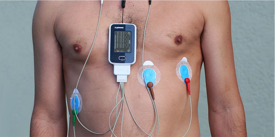 holter-monitoring-services-cdc-best-medical-lab-diagnostic-centre