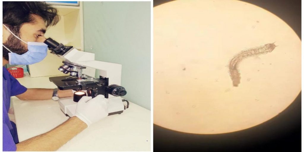 Parasitology Testing Facility CDC Best Medical Lab & Diagnostic Centre.