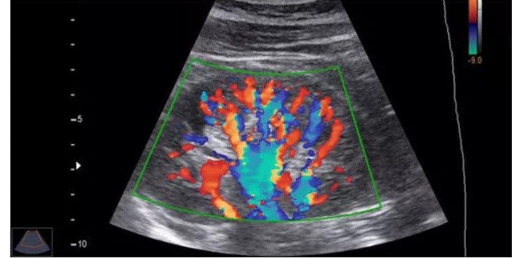 Ultrasound 3D & 4D , Anomaly Scan & KUB Ultrasound Available at CDC.